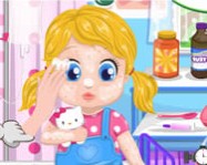 Barbies baby allergy ingyen játék